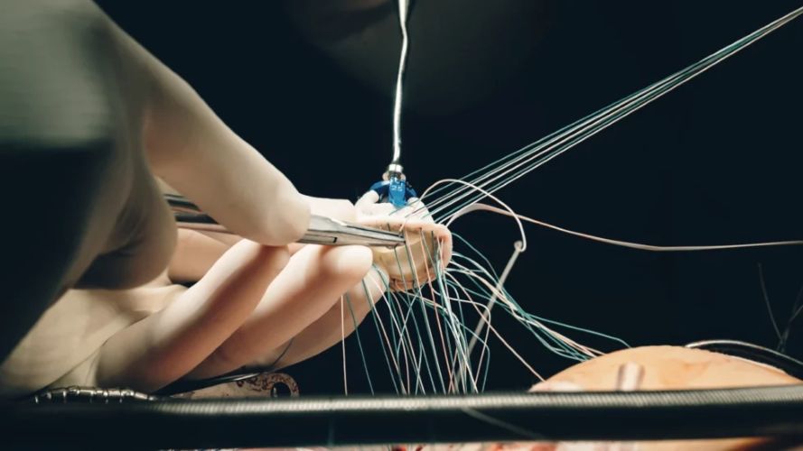 Minimally Invasive Cardiac Surgery: Transforming Heart Valve Treatments with Precision and Faster Recovery